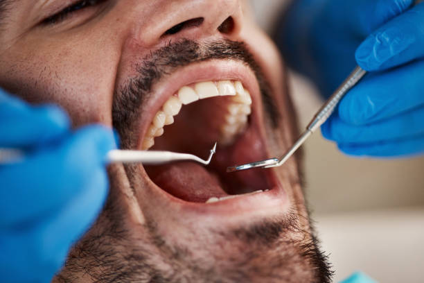 Best Same-Day Emergency Dentist in Spotsylnia Courthouse, VA