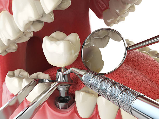 Best Weekend Emergency Dentist in Spotsylnia Courthouse, VA